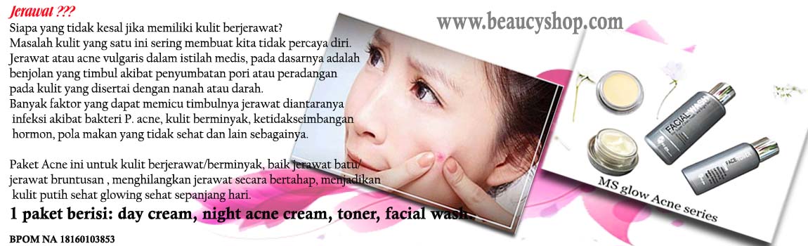 Cream pemutih wajah Aman terdaftar Bpom|MS Glow|Beaucyshop